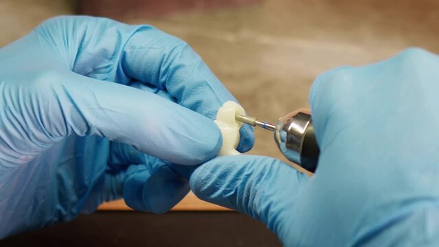 Zirconium porcelain and implant studies in the Dental Laboratory