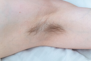 Naklejka premium Closeup of long dark hair growing under arm of young female. Concept of hygiene, natural beauty, feminity and body hair growth