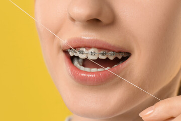Obraz premium Woman with braces cleaning teeth using dental floss on yellow background, closeup
