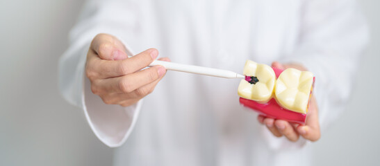 Dentist with tooth Anatomy model. Oral Teeth decay and disease, Scrape off tartar. March Oral...