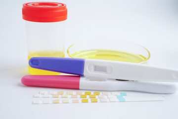 Urinalysis, pregnancy test and urine cup for female of ovulation day, fetus, maternity, childbirth,...