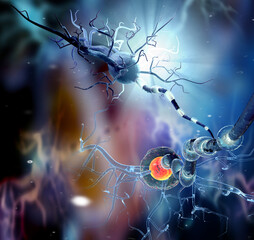Illustration of  Nerve cells, Neuron, Neurologic Disease, tumors, brain surgery. 3d Illustration