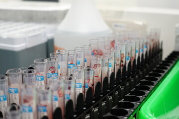 Blood collection tubes.