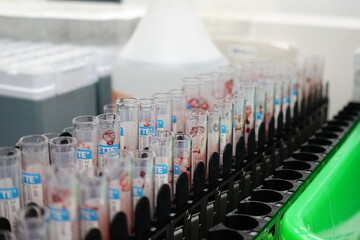 Blood collection tubes.