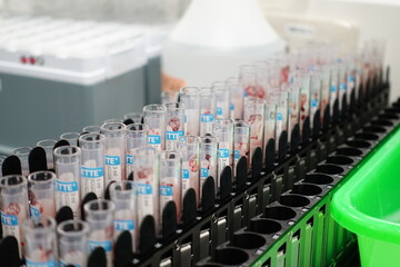 Fototapeta premium Blood collection tubes.