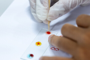 Blood group and rh factor testing by Doctor and Make a permanent slide In the Laboratory. 