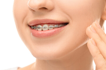 Smiling woman with dental braces on white background, closeup