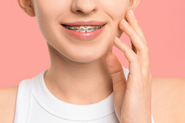 Smiling woman with dental braces on pink background, closeup