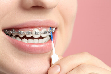 Fototapeta premium Smiling woman with dental braces cleaning teeth using interdental brush on pink background, closeup