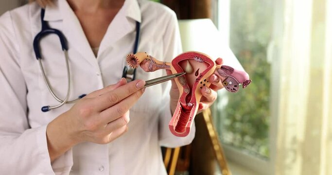 Gynecologist points with pen to anatomical model of uterus and ovaries. Doctor demonstrates structure of female reproductive organs