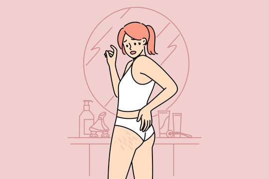 Woman sees cellulite on butt and thighs standing near mirror, and needs consult trainer to combat excess weight. Cellulite causes fear in girls, want to lose weight or improve own body