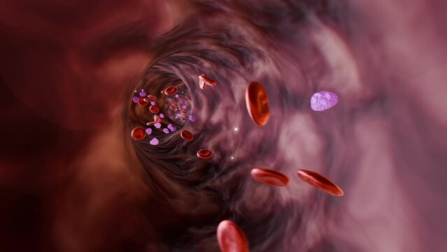 Blood Vessel: Leukemia In Bloodstream