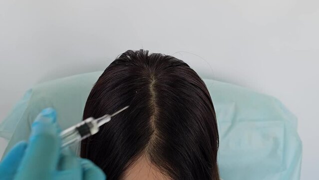 Cosmetologist does prp therapy against hair loss and anti-dandruff of a beautiful brunette woman in a beauty salon