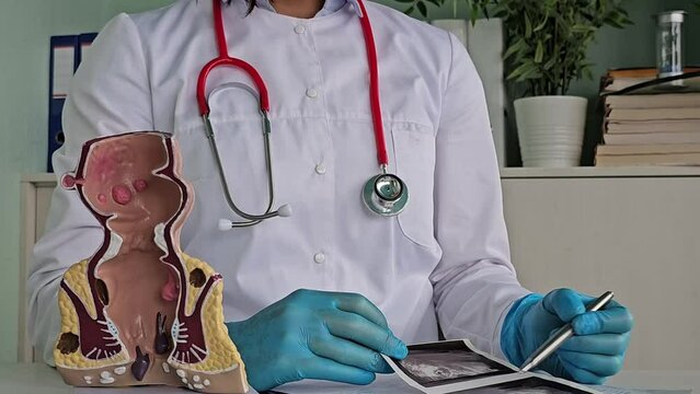 Doctor rectal examination and transrectal ultrasound. Transabdominal ultrasonography detects ulcers and diverticulosis