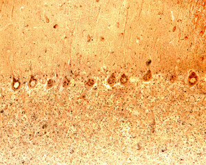 Cerebellum. Purkinje neurons. Golgi apparatus