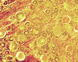 Dorsal root ganglion neurons. Golgi apparatus