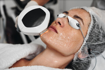 A woman receives IPL therapy in a beauty salon.