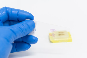 Scientist wear blue glove holding slide and out of focus paraffin human tissue block on white...