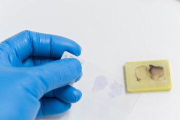 Scientist wear blue glove holding slide and out of focus paraffin human tissue block on white...