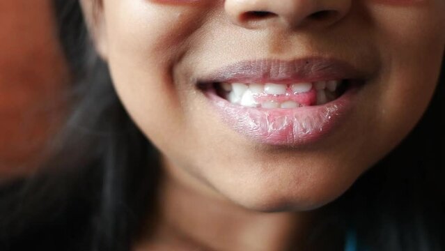 detail shot of child with teeth missing