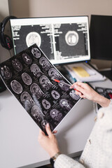 Female doctor examine an MRI image of the brain in an MRI room sitting at computer. Blurred image	