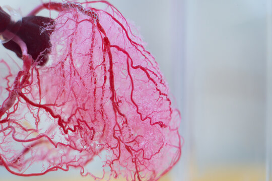cardiovascular system background It is a medical procedure used to display images of blood vessels