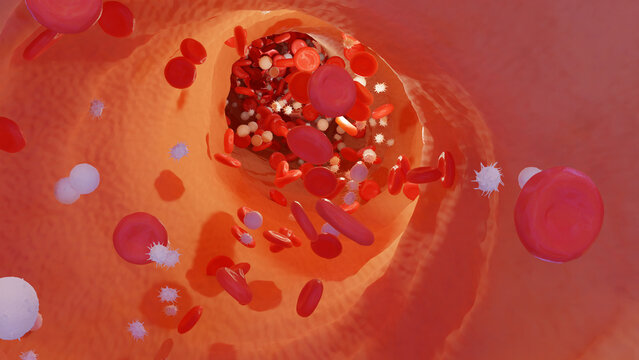 3d generated image of red and white blood cells in the bloodstream