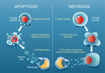 Apoptosis or Necrosis. Death of a cell