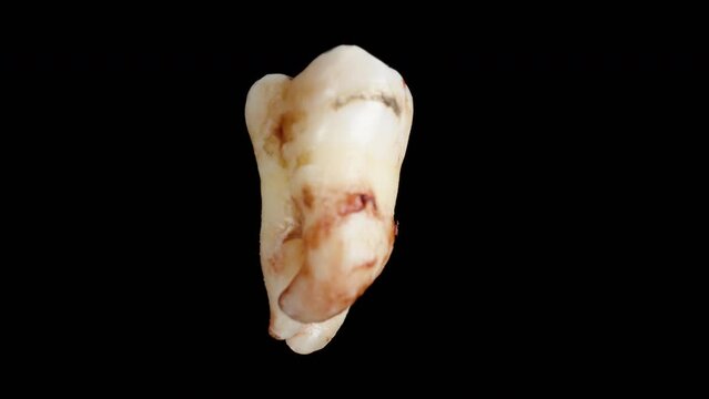 Human tooth in blood, macro, looping rotation on a black background.