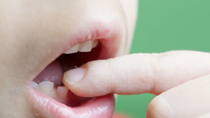 Close up on childs milk teeth. Boy wigling his tooth . High quality photo