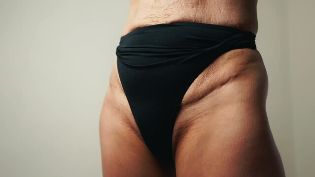 Post-Baby Body: Woman Flaunts Wrinkles, Scars, and Stretch Marks in Panties