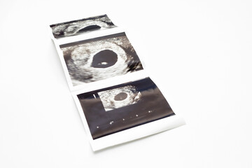 Ultrasound Picture Of 6 Weeks Fetus of Pregnant Woman, Embryo Image On White Background. Selective Focus. Fetus Development, Pregnancy Health Checking. Maternity, Horizontal