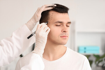 Doctor marking young man's head with hair loss problem in clinic, closeup