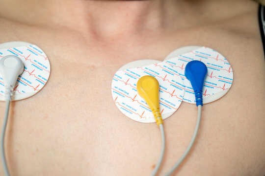 Electrodes on the human body. Holter, heart rhythm studies. The inscription ecg electrode universal.