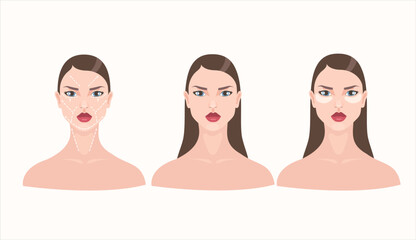 Obraz premium Vector featuring portraits of three brunette women with enhanced lips: one with face-lift markings, one with a clear face, and one with facial patches.
