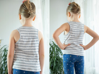 Different views healthy child's back in multiple postures, five-year-old child, young girl stands...