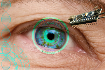 Installing electronic chip into human bionic, neuroprosthetic eye, cutting-edge technology,...