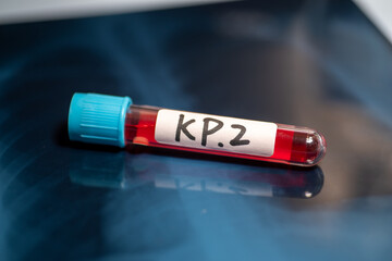 KP.2 is one of several variants being referred to as “FLiRT variants,” named after the...