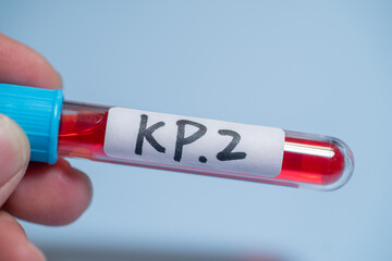 KP.2 is one of several variants being referred to as “FLiRT variants,” named after the...
