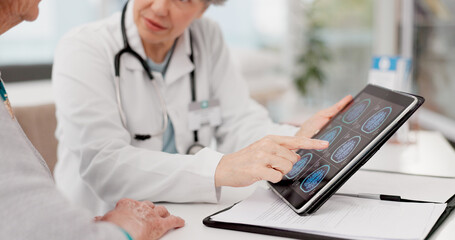 Woman, doctor and hands on tablet with brain scan or patient in medical examination, results or...