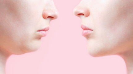 Profile of female face with and without second chin, concept before and after plastic surgery.