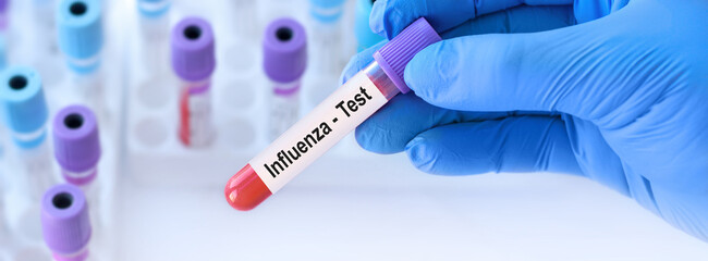Doctor holding a test blood sample tube with influenza test on the background of medical test tubes...