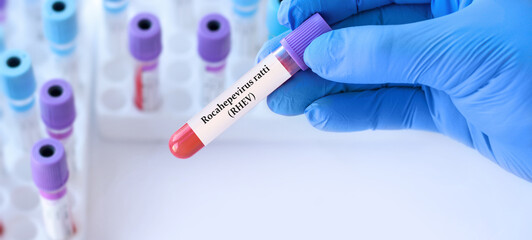 Doctor holding a test blood sample tube with Rocahepevirus, ratti, (RHEV) virus test on the...