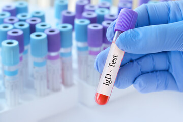 Doctor holding a test blood sample tube with IgD (Immunoglobulin D) test on the background of...