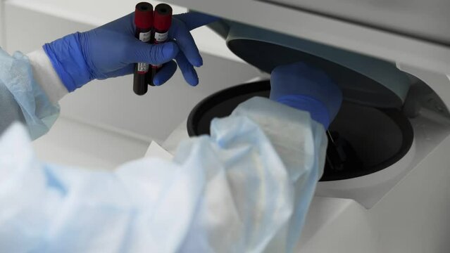 Laboratory centrifuge. Rotation of medical samples in a laboratory centrifuge. Medical centrifuge operation