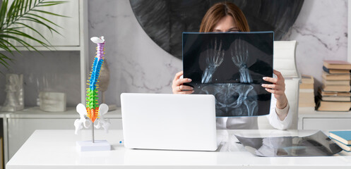 Young attractive female doctor orthopedist demonstrating the problem on spine bone model on the...
