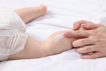 Woman applying body cream onto baby`s leg on bed, closeup