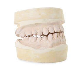 Dental model with jaws isolated on white. Cast of teeth
