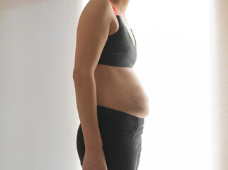 A fat Asian woman in black pants with stretch marks after childbirth has a hunched back