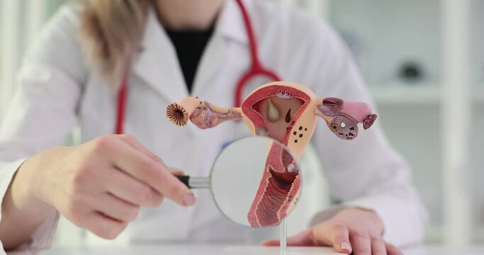 Gynecologist with magnifying glass and model of healthy uterus